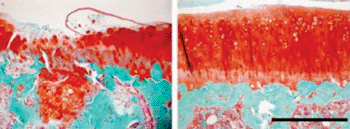 Image: TGF-beta1 Antibodies Effectively Halt Osteoarthritis in Mice. When placed in the bone (green) beneath the cartilage (red) of a rat's knee joint, antibodies against the protein TGF-beta1 can prevent the damage caused by osteoarthritis. Left, without treatment; right, with treatment (Photo Dr. Gehua Zhen, courtesy of Nature Medicine).